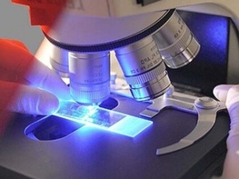 Показатели спермограммы для зачатия: нормы, отклонения