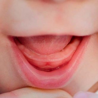 Режутся зубки у ребенка: как помочь в этот момент