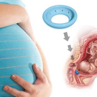 Акушерский пессарий: что это такое и в когда назначают?