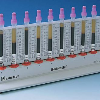 Какими должны быть показатели СОЭ на разных сроках беременности