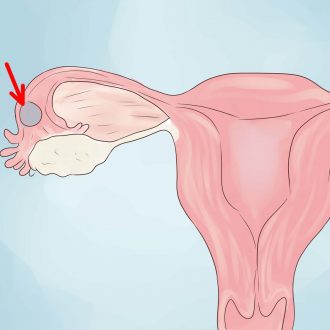 Боль и симптомы при внематочной беременности