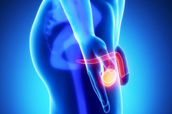 Может ли быть бесплодие при ударе в яичко