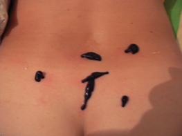 Пиявки при бесплодии