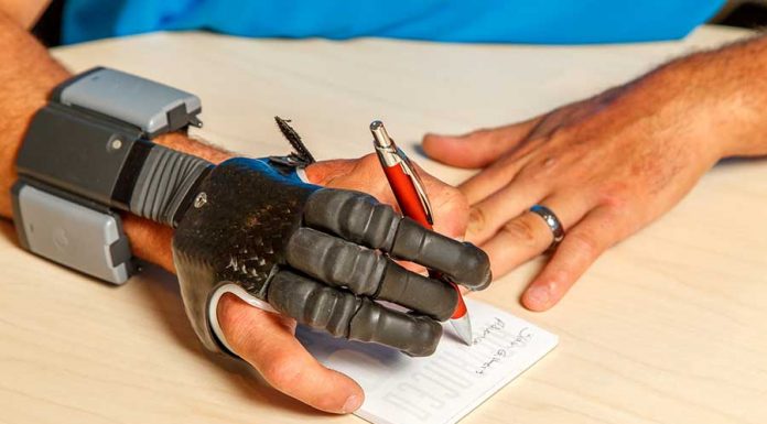 Что делать, когда нужен протез руки?