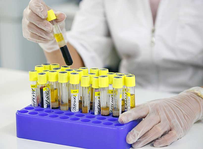 Если фибриноген в крови определяется выше нормы — что это значит?