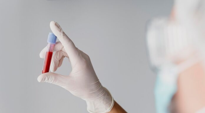 Анализы крови: важный инструмент диагностики