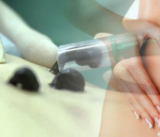 Пиявки при бесплодии – эффективный метод лечения у женщин и мужчин