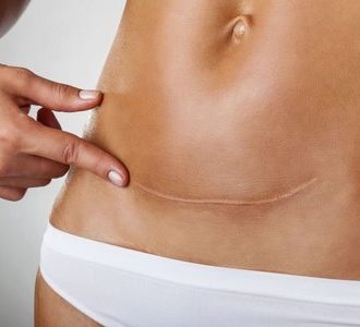 Книга; Как зачать ребенка