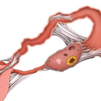 Трубное бесплодие: причины, диагностика, лечение