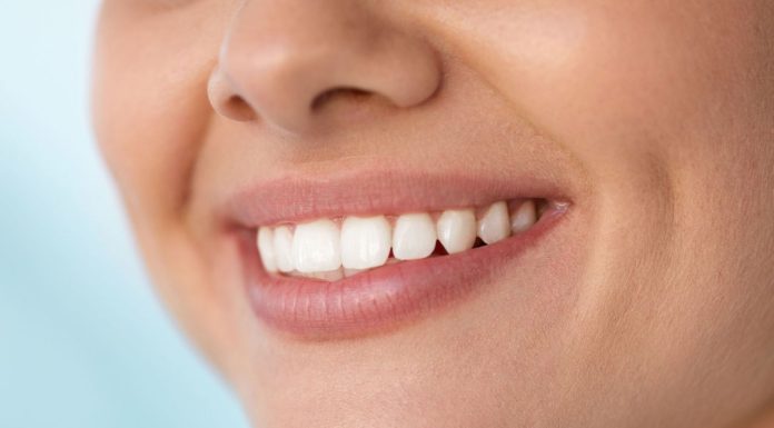 Как ухаживать за зубными имплантатами?