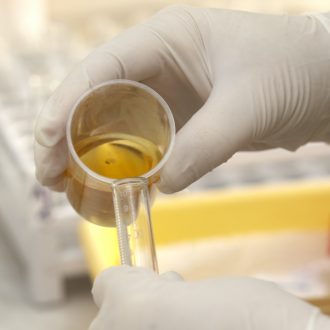 Чем опасен белок в моче при беременности?