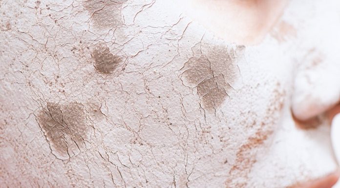 Проблемная кожа: как справиться с помощью пенки