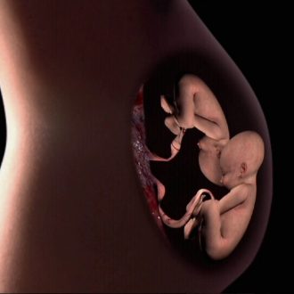 Как получаются монозиготные близнецы и могут ли они быть разного пола?