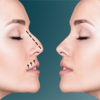 Что такое профилопластика и волюметрия лица?
