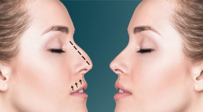 Что такое профилопластика и волюметрия лица?