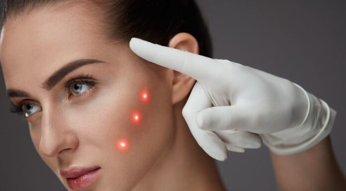 Стоит ли делать лазерное омоложение лица?