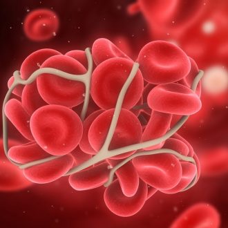 АЧТВ: подготовка к анализу, сроки выполнения, нормальные значения, отклонения от нормы