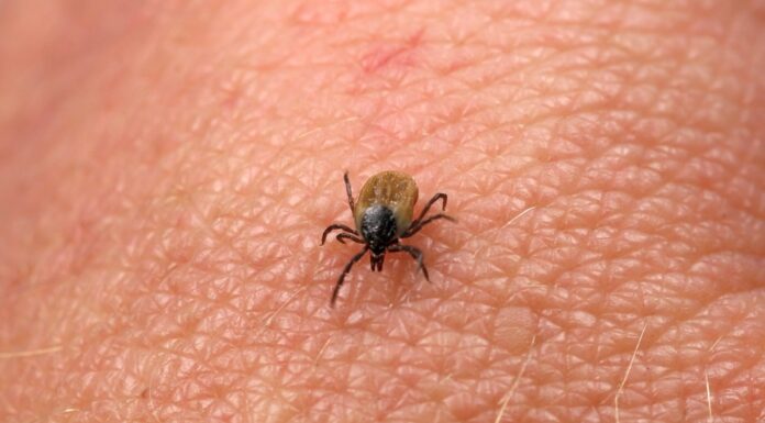 Где сдать анализ на боррелиоз?