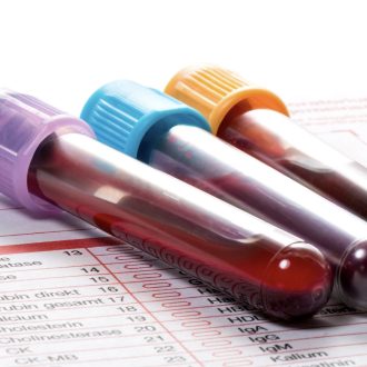 Биохимический анализ крови: кому его назначают и что он показывает