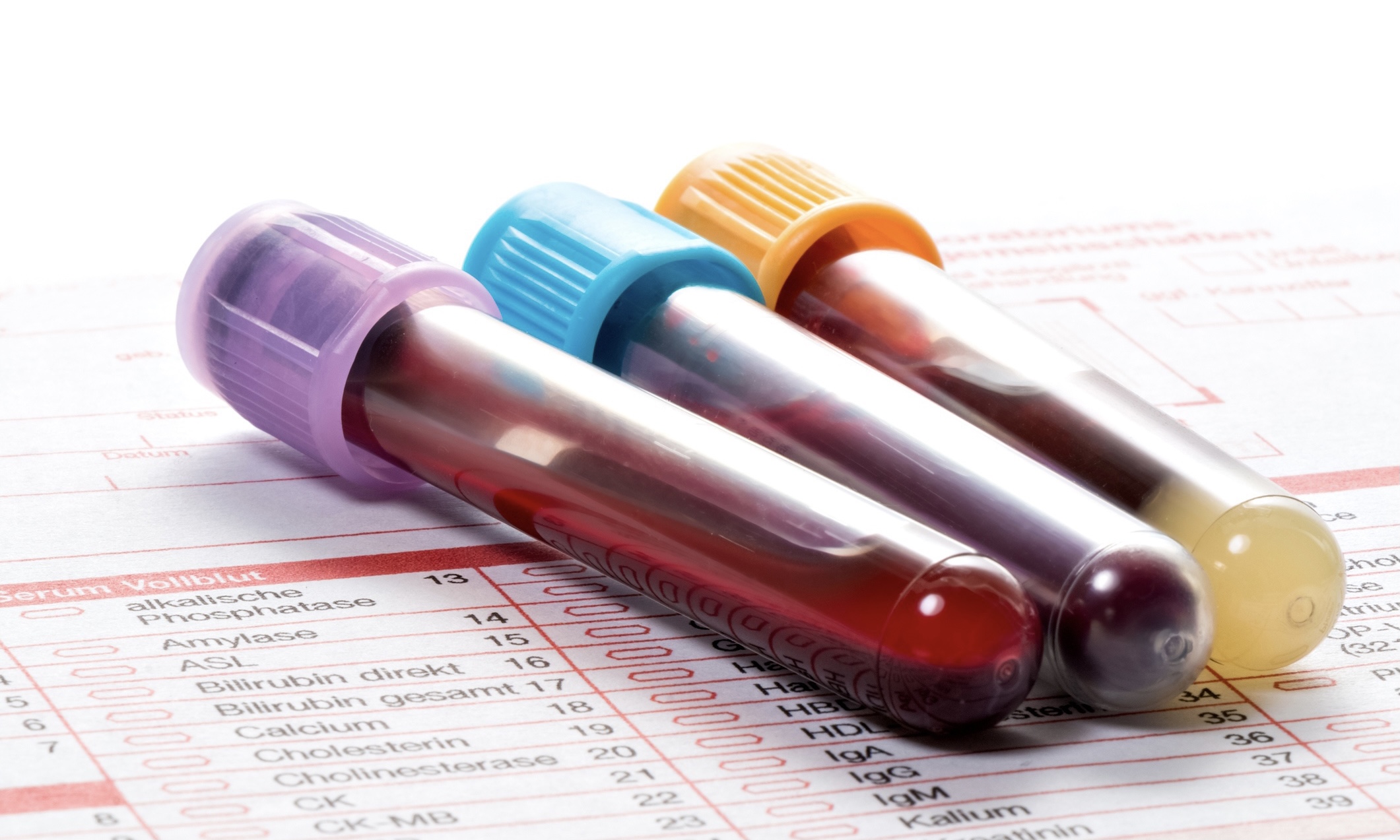Биохимический анализ крови: кому его назначают и что он показывает