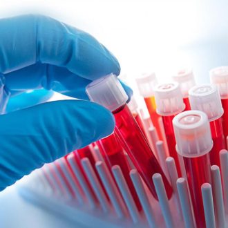 Врач гематолог: специалист по лечению кроветворных и злокачественных заболеваний крови