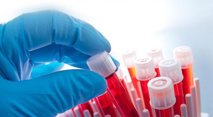 Врач гематолог: специалист по лечению кроветворных и злокачественных заболеваний крови