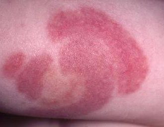 Вязание бесплатные схемы — секционного крашения, меланжевая