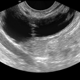 Лечение бесплодия в Университетской клинике «Я здорова! », узнать цены в медицинских центрах Москвы