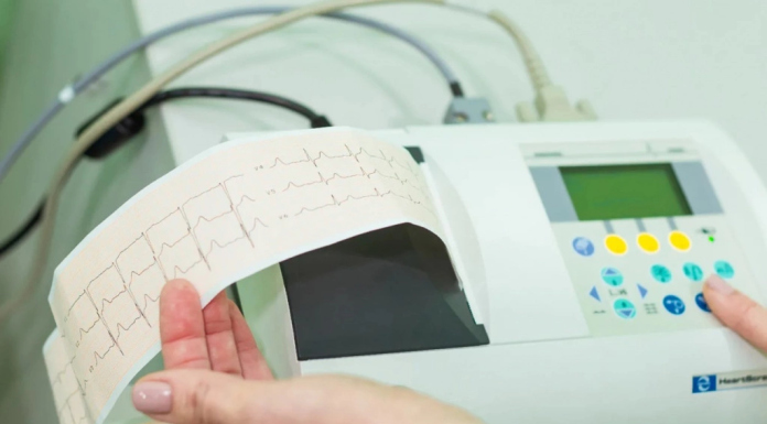 Особенности электрокардиографической диагностики