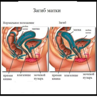 Массаж организма женщины для зачатия (чтобы забеременить)