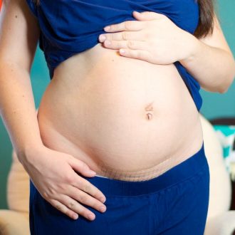 На каком сроке делают второе кесарево сечение и какие к нему показания?