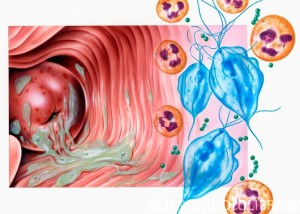 Кольпит: причины, диагностика и лечения | Проблемы мужского и женского бесплодия и методы их решения