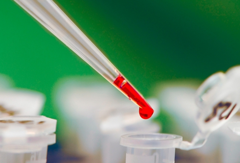 Для чего и как делают коагулограмму крови?