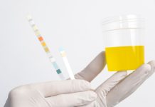 Анализ биохимии мочи: ключевые аспекты freepik