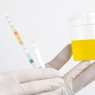 Анализ биохимии мочи: ключевые аспекты freepik