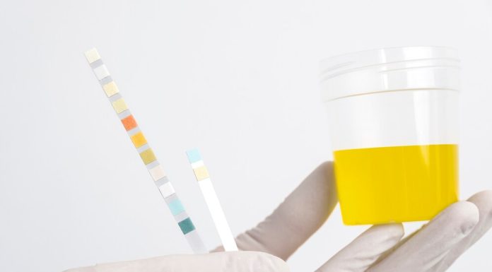 Анализ биохимии мочи: ключевые аспекты freepik