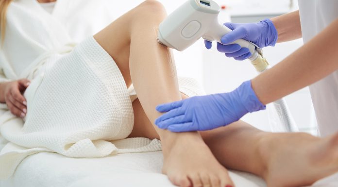 Все, что вам нужно знать о лазерной эпиляции
