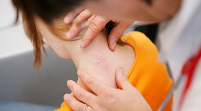 Лечение и диагностика псориаза