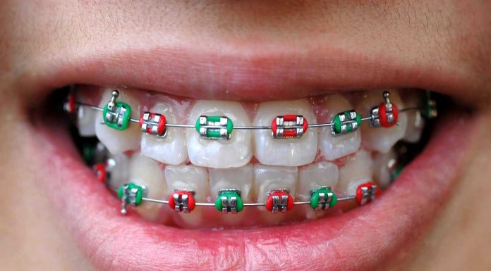 Как выбрать хорошего ортодонта: образование, рекомендации и отзывы