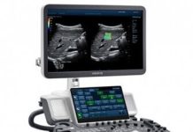 Как выбрать УЗИ аппарат: почему компания MST, какие УЗИ аппараты лучше