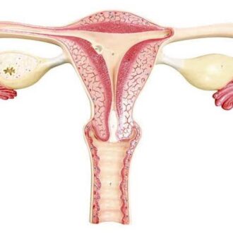 Непроходимость маточных труб: симптомы и лечение народными средствами