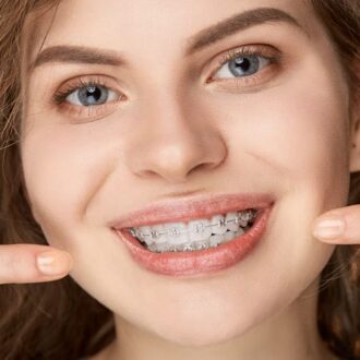 Брекеты: классификация, характеристика металлических брекетов, керамические брекеты, сапфировые брекеты