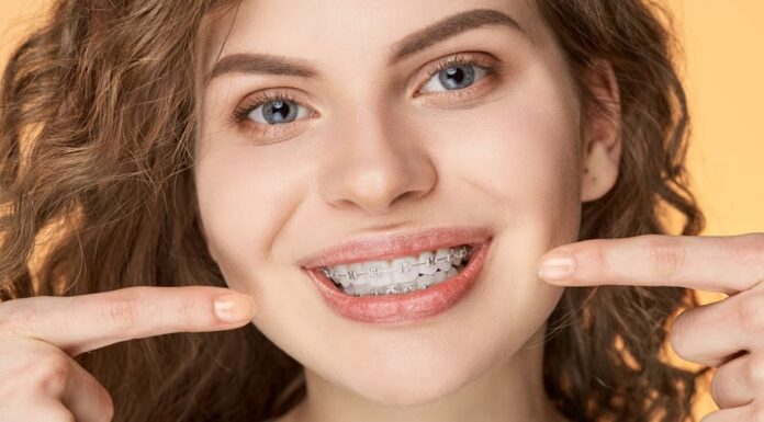 Брекеты: классификация, характеристика металлических брекетов, керамические брекеты, сапфировые брекеты