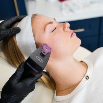 Всё о РФ-лифтинге: что это, как работает и кому подходит