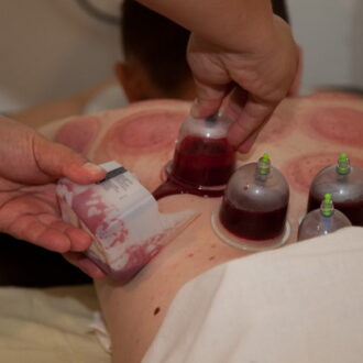 Хиджама при бесплодии у женщин: отзывы, подробное описание