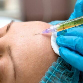 Факты о плазменной подтяжке лица