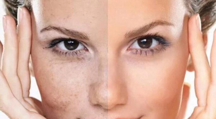 Какой эффект ждать от использования пилинга?