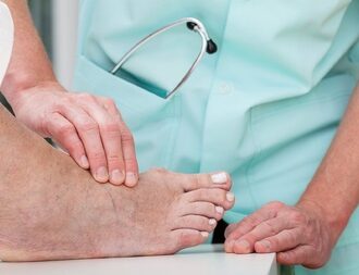 Управление отеками у лежачих больных: причины, профилактика и лечение