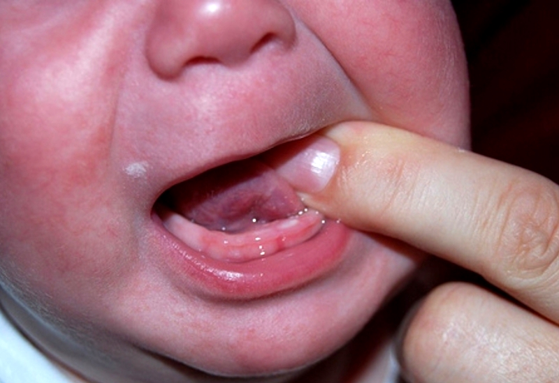 Чем облегчить боль у малыша при прорезывании зубов?