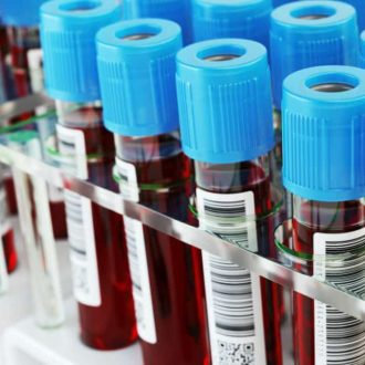 Иглы-бабочки: эффективный способ взятия крови